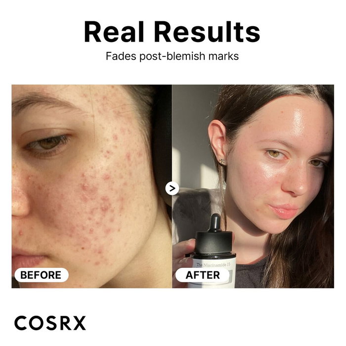 Cosrx The Niacinamide 15 Sérum 20 ml