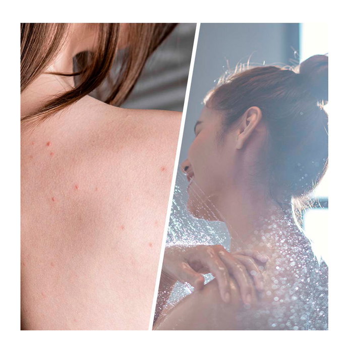Biovène Salicylic Blemish Scrub Detoxifying Gommage Anti-Imperfections à l'Arbre à Thé Bio 250 ml Biovène Salicylic Blemish Scrub Detoxifying Gommage Anti-Imperfections à l'Arbre à Thé Bio 250 ml