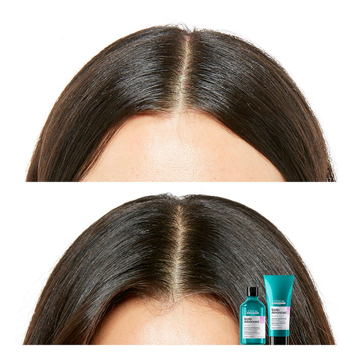 L'Oréal Professionnel Paris Shampoing Scalp Advanced Cuir Chevelu Sensible 300 ml