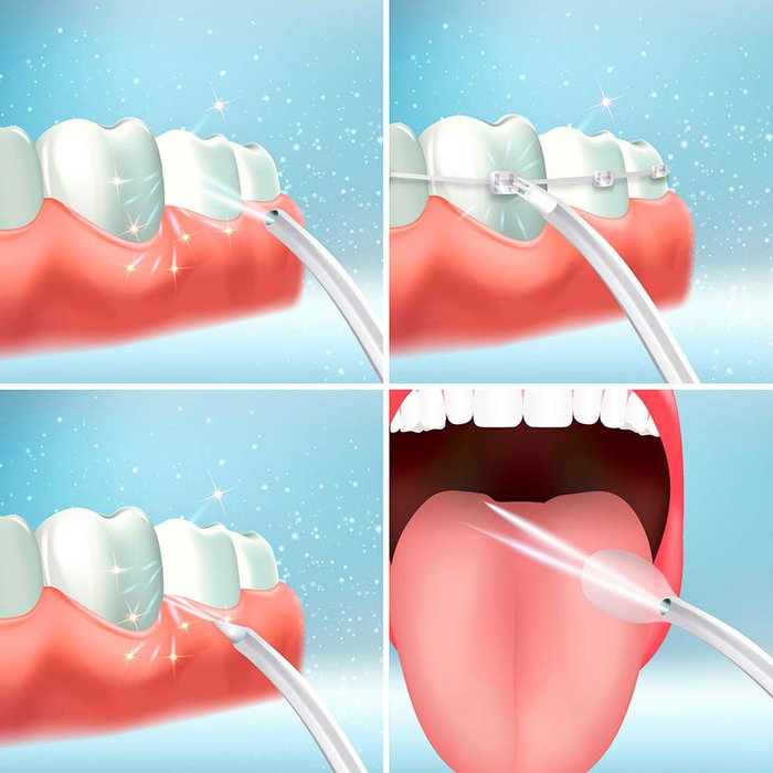 Irrigateur Buccal Rechargeable Portable Denter InnovaGoods